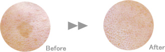 ���� Before/After